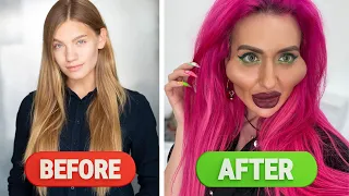 Celebrities Before and After Plastic Surgery | Anastasia Polischuk |