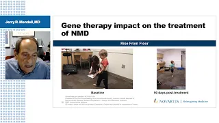 Novartis Gene Therapies Industry Update Webinar “Gene Therapies  Redefining Treatment in Neuromuscul