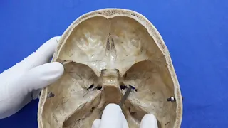 Interior of cranial cavity- middle cranial fossa