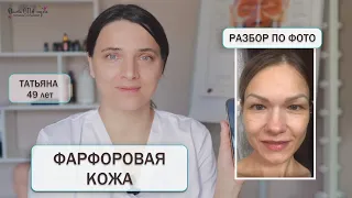 АСИММЕТРИЯ ЛИЦА И ТОНКАЯ КОЖА. Рекомендации по фото.