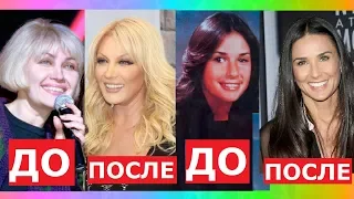 ЗВЁЗДЫ, которым ПЛАСТИКА пошла НА ПОЛЬЗУ!