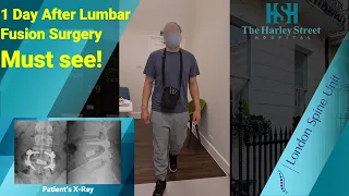 1 Day After Lumbar Fusion Surgery - Must See !