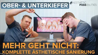 Von 0 auf 100 mit 8 Implantaten und 17 Keramikkronen 😱! Komplettes makeover vorher -nachher