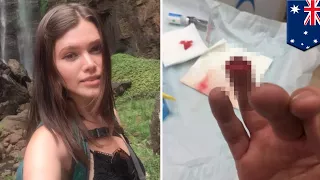 Backpacker loses tip of finger in farming accident - TomoNews