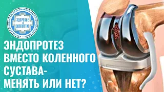 🦿 Эндопротез вместо коленного сустава - менять или нет?