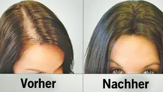 Diese natürlichen Hilfsmittel stoppen Haarausfall und lassen die Haare schneller wachsen!