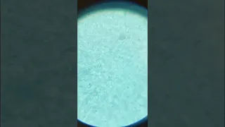 Sperm Under Microscope 640x