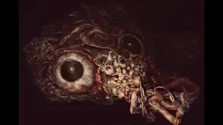 Evil Eye/Mother Brain (Location, Living String, Moon Rune) - Bloodborne