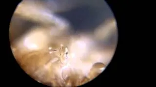 Study of a common fruit fly - length: ~13 min