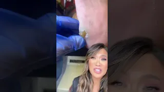 'How so you even walk around with that?' - Dr.Pimple Popper Reacts