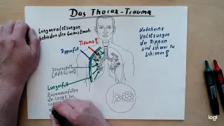 Thoraxtrauma