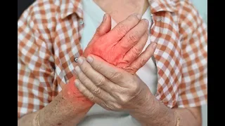 Common Arthritis Conditions - Osteoarthritis vs. Rheumatoid Arthritis