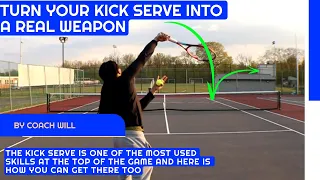 From Get it In to WIN!!! Get a killer Second Serve