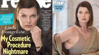 DISFIGURED SUPERMODEL SPEAKS OUT ~ COOLSCULPTING NIGHTMARE 😱