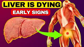 6 Weird Signs That You Have Liver Damage || HealthQuest