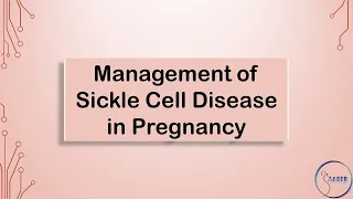 RCOG GUIDELINE Management of Sickle Cell Disease