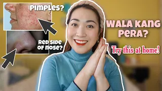 KAHIT WALA KANG PERA 💰 MGA EFFECTIVE PAMPAWALA NG PIMPLES NA DAPAT MONG SUBUKAN ❤️ayaesguerra