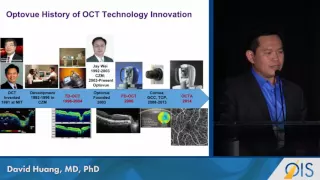 A History of OCT-A (OIS@ASRS 2016)