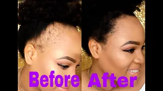 INSTANT FAKE EDGES/ THIN OR BALD EDGES? NO MORE WORRIES
