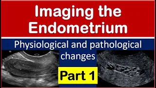 Imaging of the endometrium physiological and pathological changes part 1