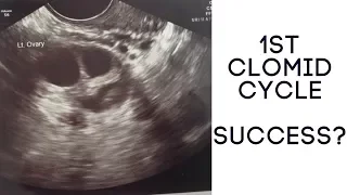 1ST CLOMID CYCLE | SUCCESS? | THE RALLS FAMILY
