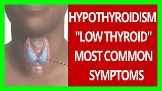 Signs That You Have a Low Thyroid Level | Hypothyroidism, Symptoms and Causes