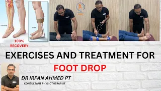 Drop foot Causes, Physiotherapy Treatment &Exercises | Surgery options for drop Foot |Urdu |Hindi