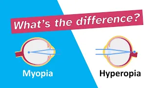 What's the difference between myopia (nearsightedness) and hyperopia (farsightedness)