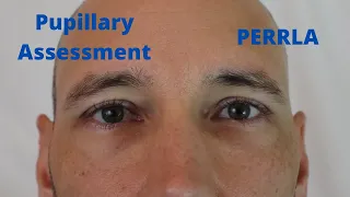 Pupillary Assessment (PERRLA)