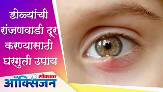 डोळ्यांची रांजणवाडी दूर करण्यासाठी  घरगुती उपाय | Home Remedies | RANJANVADI | Lokmat Oxygen