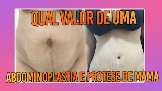 QUAL VALOR DE UMA ABDOMINOPLASTIA E PRÓTESE DE MAMA -  CIRURGIA PLÁSTICA