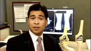 Robotically Assisted Partial Knee Replacement