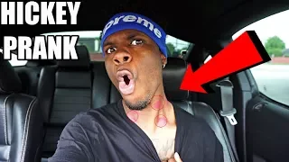 HICKEY PRANK ON GIRLFRIEND!!! (UNEXPECTED REACTION)