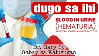 Hematuria: Blood In Urine - Dr. Gary Sy