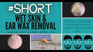 WET SKIN & EAR WAX REMOVAL