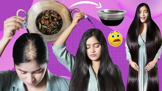 I Applied Just 1 Drop Of This Diy & Got Massive Hair Growth गंजे सर पर बाल वापस आ गए MostPowerfulDiy