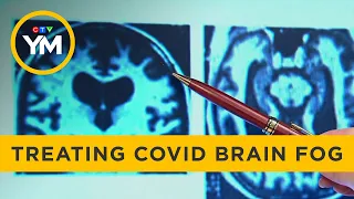 Addiction drug shows potential to treat COVID “brain fog” | Your Morning