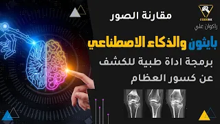 بايثون والتعلم العميق برمجة اداة طبية مقارنة صور للكشف كسر العظام python AI openCV