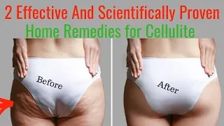 How to Get Rid of Cellulite with Home Remedies - How to Get Rid of Cellulite on Thighs