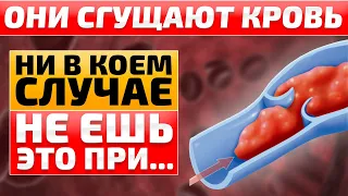 Осторожно – тромбы! Какие продукты загущают кровь и делают тромбы