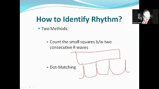 ECG MADE EASY DAY-2 By Dr.Sairah Sadaf. Live Zoom session 14th May,2024.