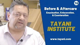 Before & After Care Enucleation, Evisceration, & Exenteration | Tayani Institute