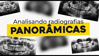 Analisando radiografia panorâmica | RADIOLOGIA