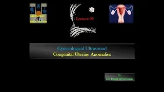 Gynecological Ultrasound -Lecture 05  -Congenital Uterine Anomalies