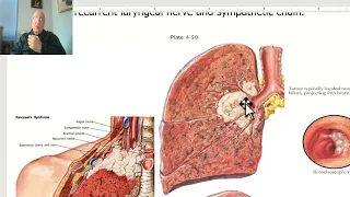 Anatomy of the thorax 2023 in Arabic(Applied anatomy of pleura & lung , part 2 ), by Dr. Wahdan