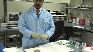 Superficial Fine Needle Aspiration Biopsy Technique, Dr. Robert Oliai PART 1