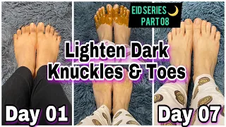 How To Lighten Dark Knuckles & Toes Naturally In 7 Days | Do this every night for 7 days #eidseries