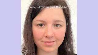 Filabé Erfahrung zur Lösung von Hautproblemen mit Nancy