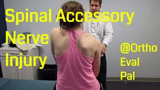 Spinal Accessory Nerve Injury Video