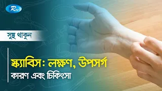 স্ক্যাবিস : লক্ষণ, উপসর্গ, কারণ এবং চিকিৎসা | Sustho Thakun | Rtv Health Program